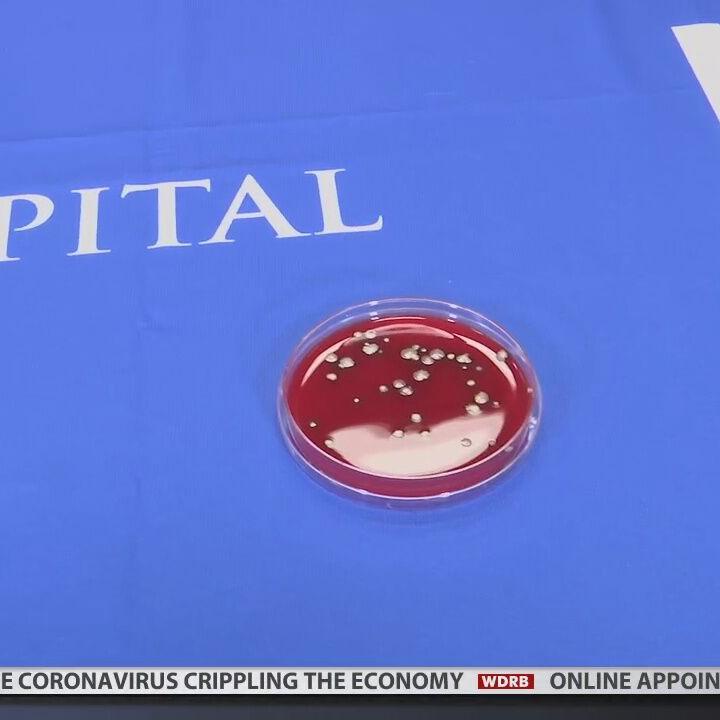 w加速器